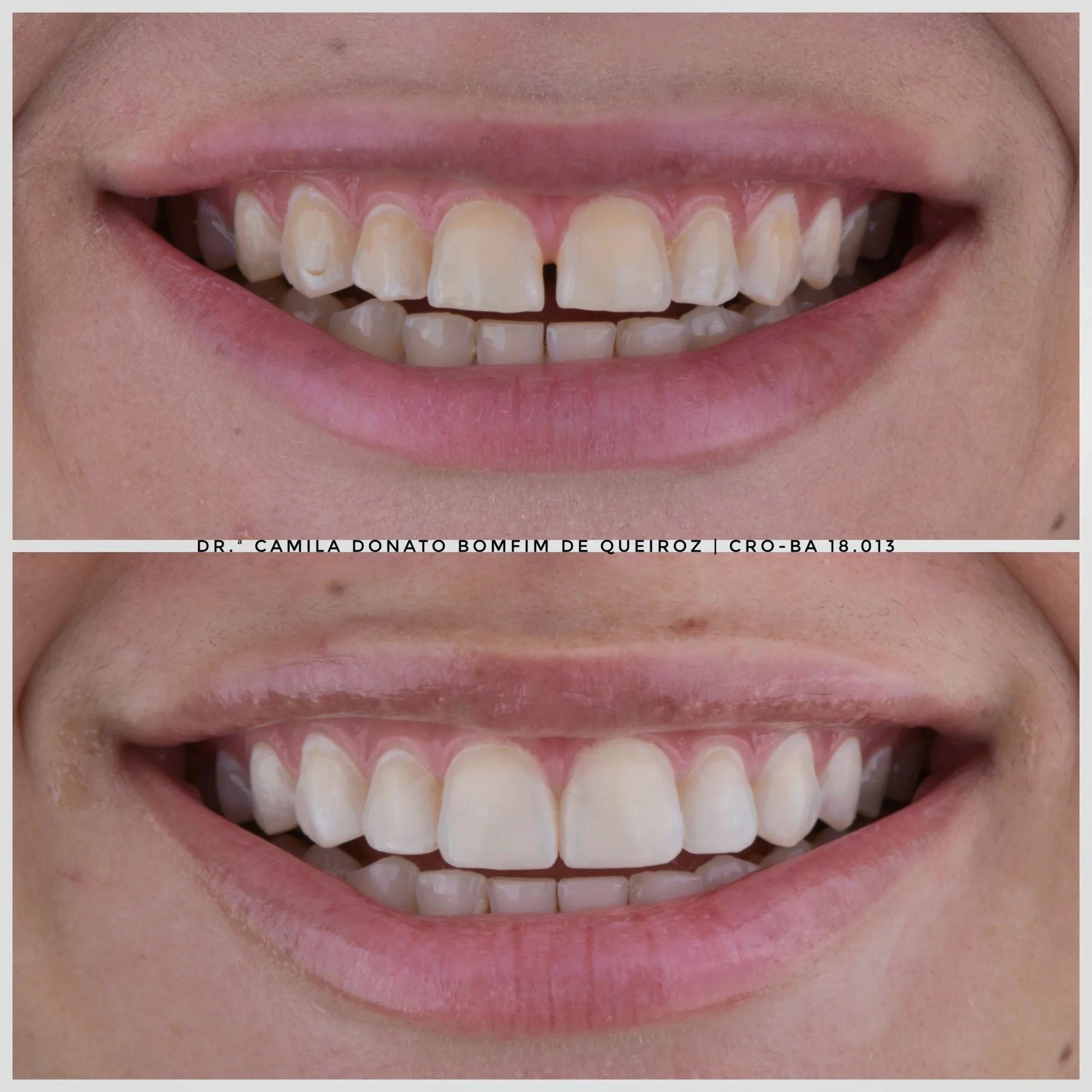 20250301_110849-1-1-1-scaled.webp