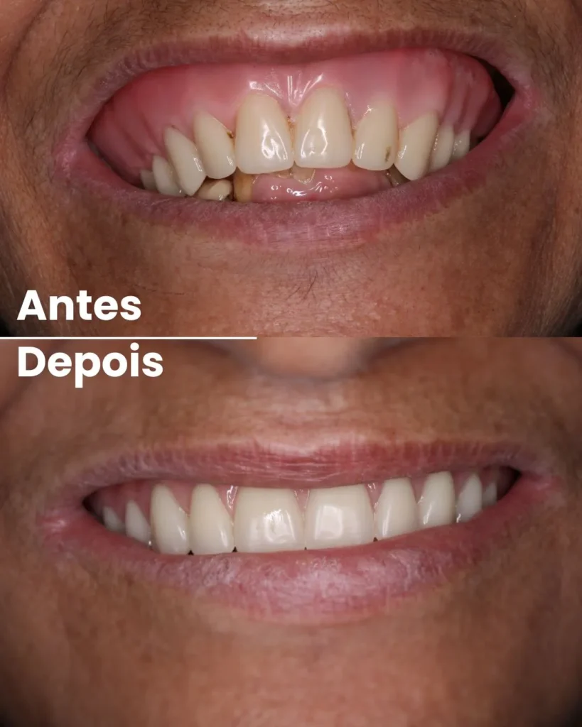 Antes.webp