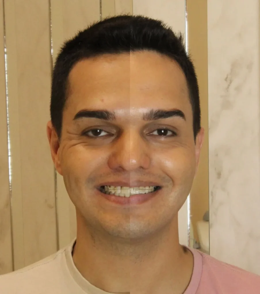 Depo harmonizacao (1)